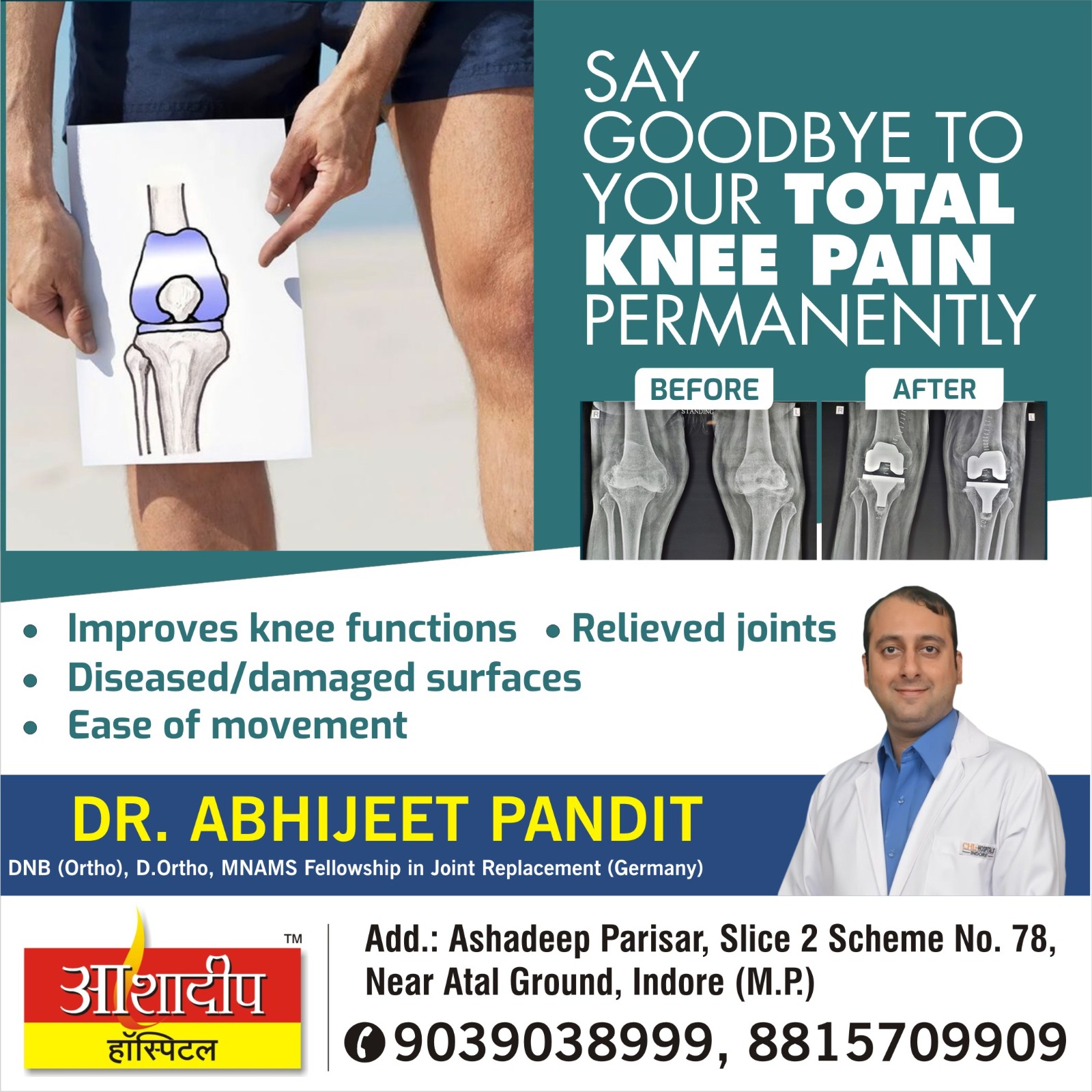 Best Total Knee Replacement Surgeon in Indore